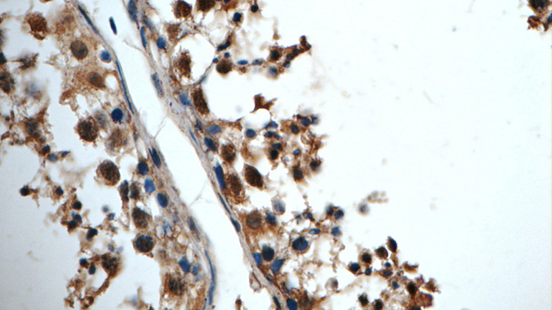 Immunohistochemistry of paraffin-embedded human testis tissue slide using Catalog No:117017(ZNF654 Antibody) at dilution of 1:50 (under 40x lens)