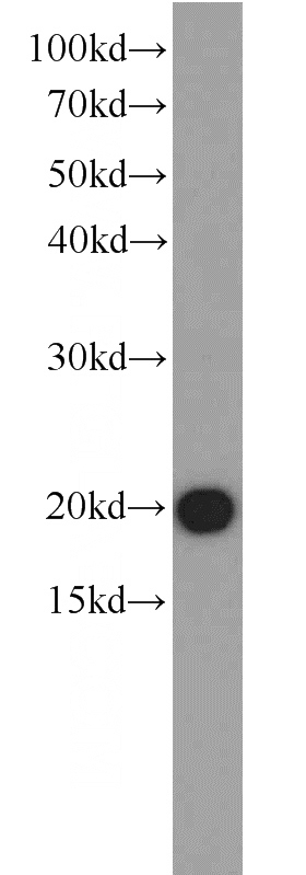 MCF7 cells were subjected to SDS PAGE followed by western blot with Catalog No:110176(EIF1AY antibody) at dilution of 1:800