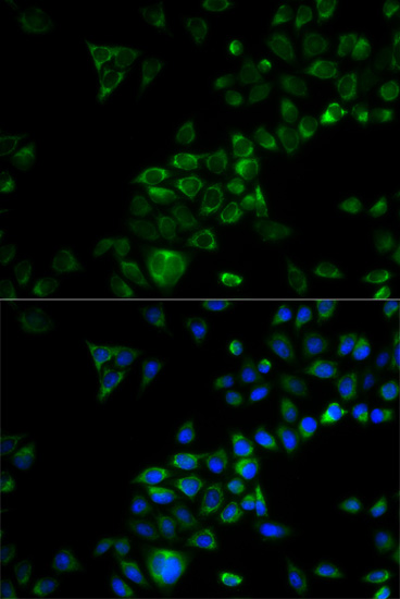 Immunofluorescence - TRAF3 Polyclonal Antibody 