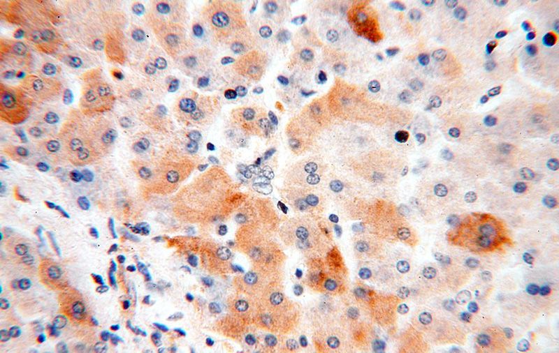 Immunohistochemical of paraffin-embedded human liver using Catalog No:116396(TRMT11 antibody) at dilution of 1:50 (under 40x lens)