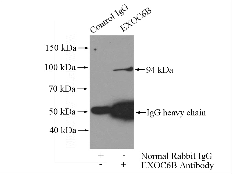 IP Result of anti-EXoc6B (IP:Catalog No:110504, 4ug; Detection:Catalog No:110504 1:500) with HEK-293 cells lysate 3200ug.