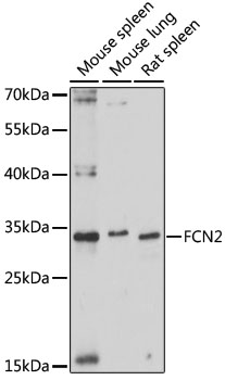 Western blot - FCN2 Polyclonal Antibody 