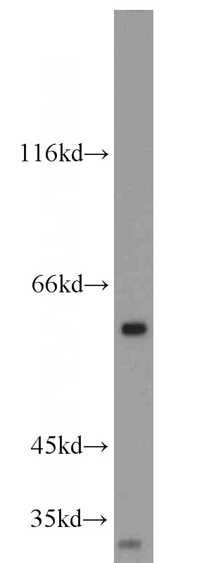 HL-60 cells were subjected to SDS PAGE followed by western blot with Catalog No:110013(TNFRSF10B-Specific antibody) at dilution of 1:200