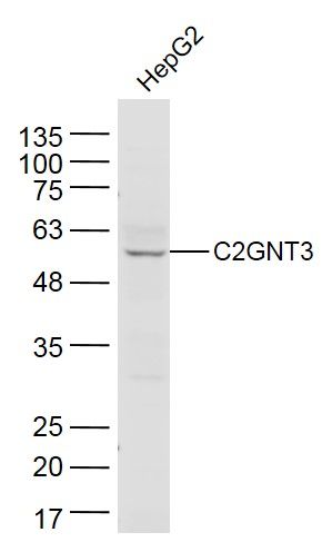 Fig1: Sample:; HepG2(Human) Cell Lysate at 40 ug; Primary: Anti-C2GNT3 at 1/300 dilution; Secondary: IRDye800CW Goat Anti-Rabbit IgG at 1/20000 dilution; Predicted band size: 53 kD; Observed band size: 53 kD