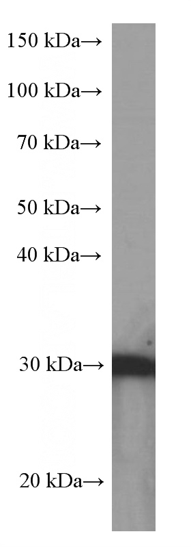 MCF-7 cells were subjected to SDS PAGE followed by western blot with Catalog No:107551(SFN Antibody) at dilution of 1:2000