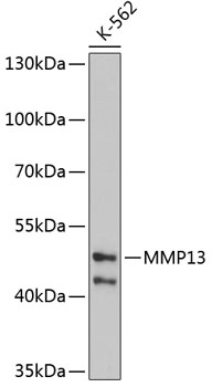Western blot - MMP13 Polyclonal Antibody 
