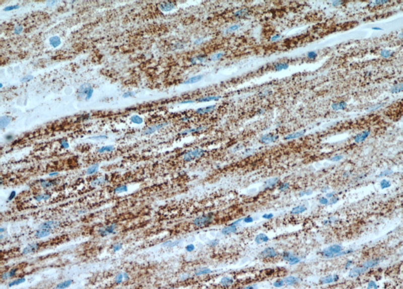 Immunohistochemical of paraffin-embedded human heart using Catalog No:112325(LRPPRC antibody) at dilution of 1:100 (under 40x lens)