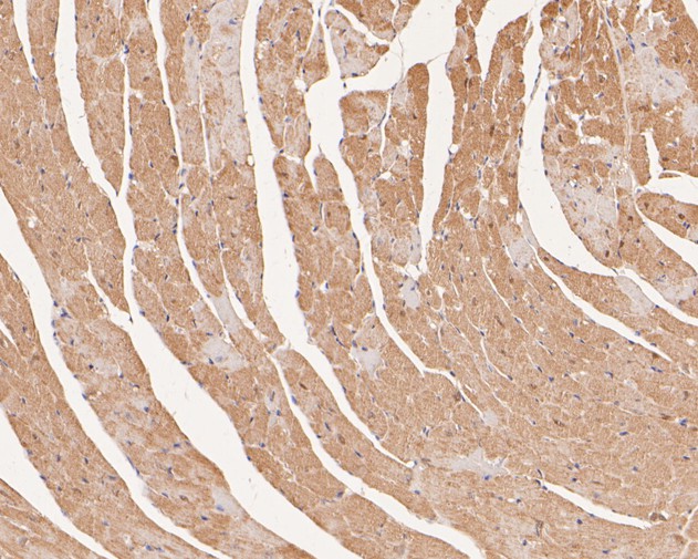 Fig3:; Immunohistochemical analysis of paraffin-embedded mouse heart tissue using anti-Ly-6G antibody. The section was pre-treated using heat mediated antigen retrieval with Tris-EDTA buffer (pH 8.0-8.4) for 20 minutes.The tissues were blocked in 5% BSA for 30 minutes at room temperature, washed with ddH; 2; O and PBS, and then probed with the primary antibody ( 1/100) for 30 minutes at room temperature. The detection was performed using an HRP conjugated compact polymer system. DAB was used as the chromogen. Tissues were counterstained with hematoxylin and mounted with DPX.