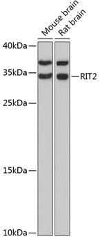 Western blot - RIT2 Polyclonal Antibody 