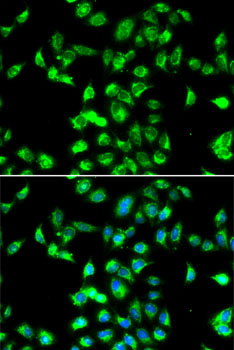 Immunofluorescence - SERPINA4 Polyclonal Antibody 
