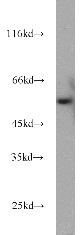 Jurkat cells were subjected to SDS PAGE followed by western blot with Catalog No:116974(WTAP antibody) at dilution of 1:1000