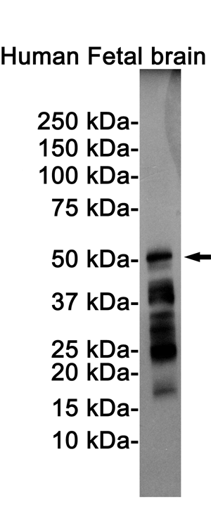 Western blot detection of Tau (Phospho-Ser198) in Human Fetal brain cell lysates using Tau (Phospho-Ser198) Rabbit pAb(1:1000 diluted).Predicted band size:79KDa.Observed band size:50-80KDa.