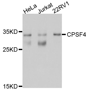 Western blot - CPSF4 Polyclonal Antibody 