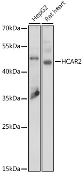 Western blot - HCAR2 Polyclonal Antibody 