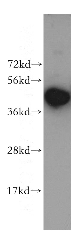 human brain tissue were subjected to SDS PAGE followed by western blot with Catalog No:112124(KRR1 antibody) at dilution of 1:500
