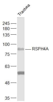 Fig2: Sample:; Trachea (Mouse) Lysate at 40 ug; Primary: Anti-RSPH4A at 1/1000 dilution; Secondary: IRDye800CW Goat Anti-Rabbit IgG at 1/20000 dilution; Predicted band size: 81 kD; Observed band size: 81 kD