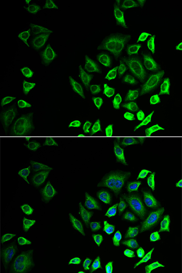 Immunofluorescence - PLA2G2D Polyclonal Antibody 