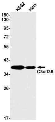 Western blot detection of C3orf38 in K562,Hela cell lysates using C3orf38 Rabbit mAb(1:1000 diluted).Predicted band size:38kDa.Observed band size:38kDa.