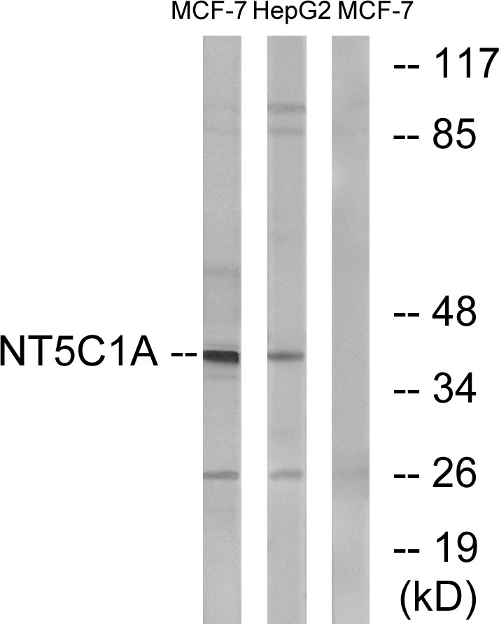 Fig1:; Western blot analysis of lysates from MCF-7 and HepG2 cells, using NT5C1A Antibody. The lane on the right is blocked with the synthesized peptide.