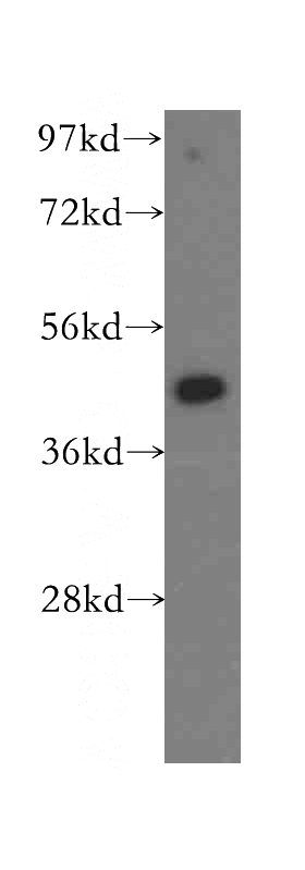 MCF7 cells were subjected to SDS PAGE followed by western blot with Catalog No:111246(OLA1 antibody) at dilution of 1:400