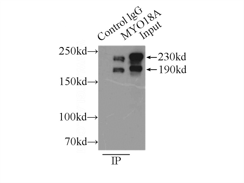 IP Result of anti-MYO18A (IP:Catalog No:112980, 3ug; Detection:Catalog No:112980 1:300) with HeLa cells lysate 3000ug.