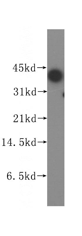 Jurkat cells were subjected to SDS PAGE followed by western blot with Catalog No:116118(TIA1 antibody) at dilution of 1:200
