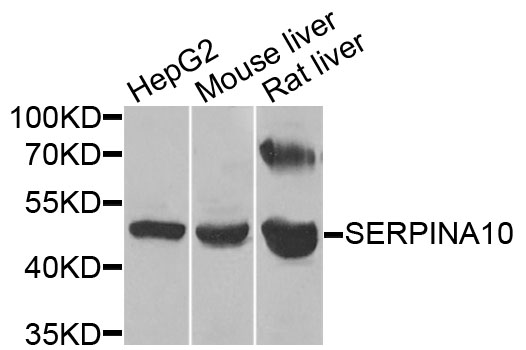 Western blot - SERPINA10 Polyclonal Antibody 