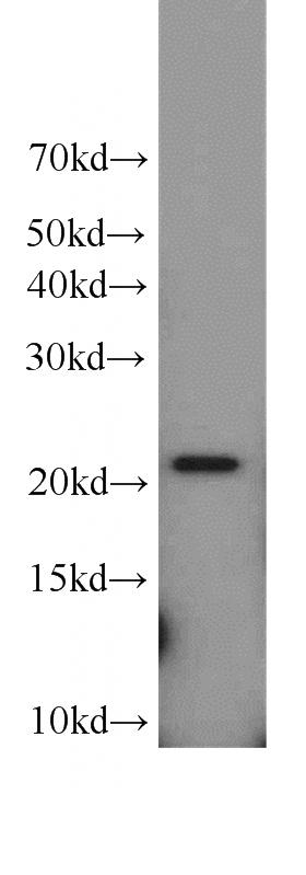 A549 cells were subjected to SDS PAGE followed by western blot with Catalog No:116287(TNFAIP8 antibody) at dilution of 1:300
