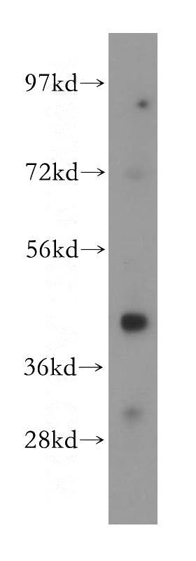 Jurkat cells were subjected to SDS PAGE followed by western blot with Catalog No:112378(MAGEA10 antibody) at dilution of 1:500