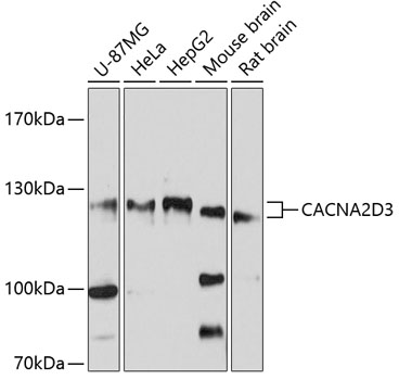 Western blot - CACNA2D3 Polyclonal Antibody 