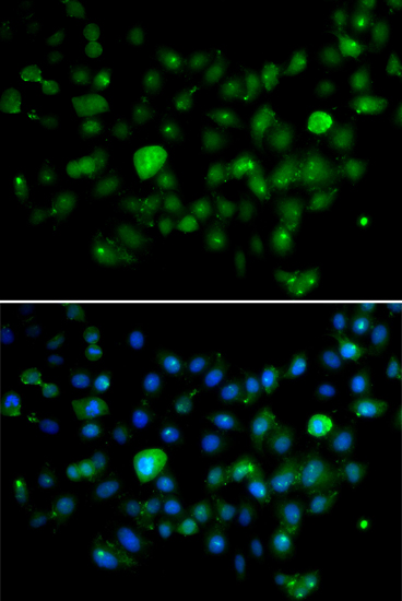 Immunofluorescence - MCM10 Polyclonal Antibody 