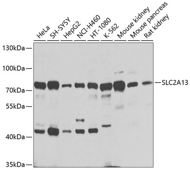 Western blot - SLC2A13 Polyclonal Antibody 