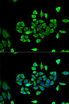 Immunofluorescence - CLCN5 Polyclonal Antibody 
