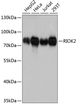 Western blot - RIOK2 Polyclonal Antibody 