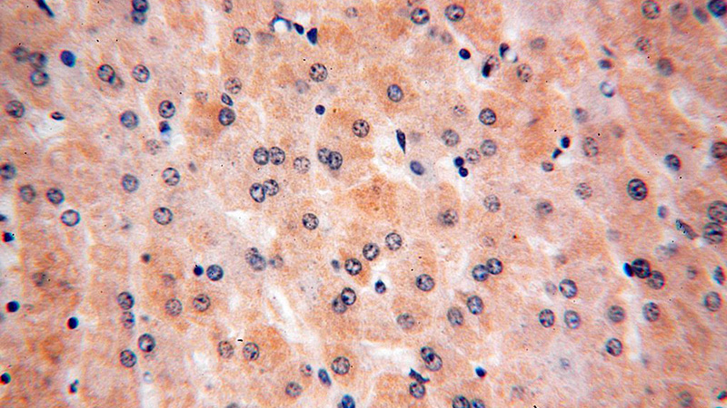 Immunohistochemical of paraffin-embedded human liver using Catalog No:116566(ULBP1 antibody) at dilution of 1:50 (under 40x lens)