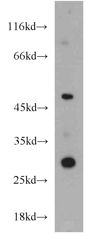 Jurkat cells were subjected to SDS PAGE followed by western blot with Catalog No:117009(ZNF597 antibody) at dilution of 1:500