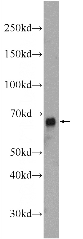 COLO 320 cells were subjected to SDS PAGE followed by western blot with Catalog No:107744(ACOT12 Antibody) at dilution of 1:600