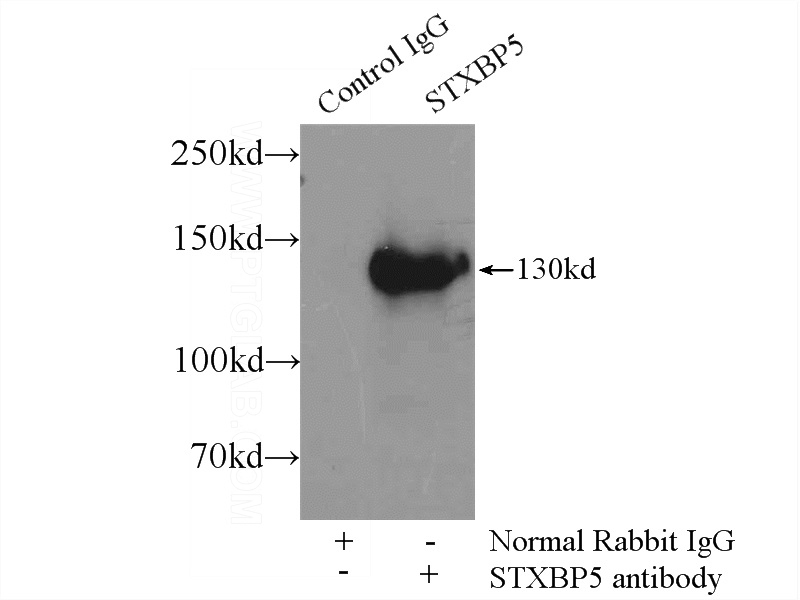 IP Result of anti-STXBP5 (IP:Catalog No:115813, 5ug; Detection:Catalog No:115813 1:300) with rat brain tissue lysate 4000ug.
