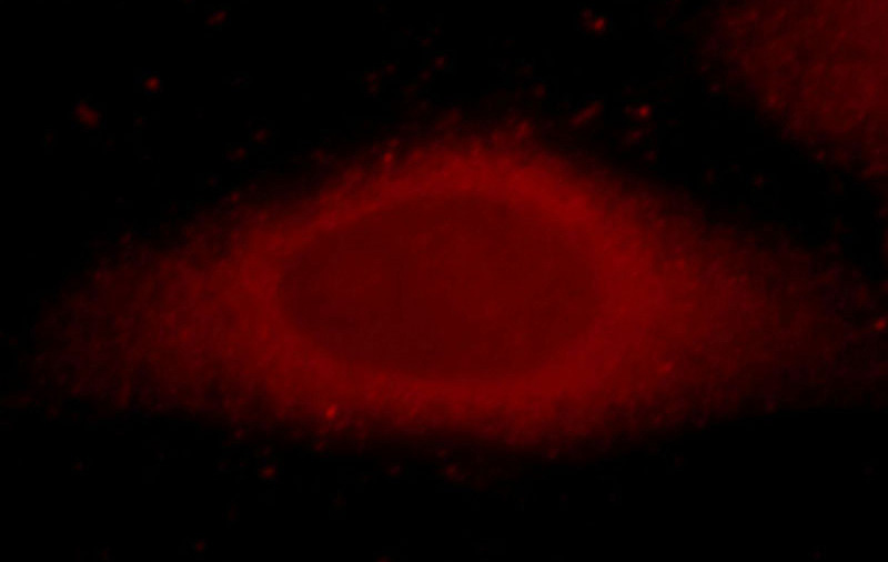 Immunofluorescent analysis of HepG2 cells, using FAM127B antibody Catalog No:110469 at 1:25 dilution and Rhodamine-labeled goat anti-rabbit IgG (red).