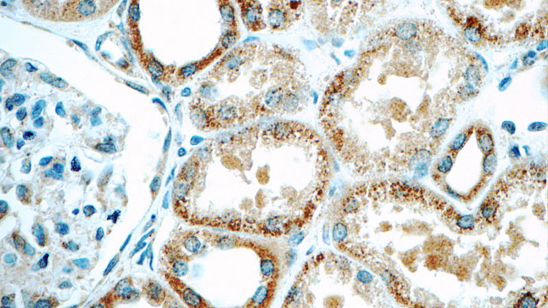 Immunohistochemistry of paraffin-embedded human kidney tissue slide using Catalog No:108737(C5orf4 Antibody) at dilution of 1:50 (under 40x lens)