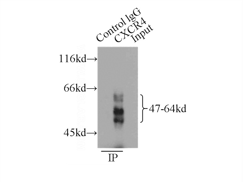 IP Result of anti-CXCR4 (IP:Catalog No:109644, 3ug; Detection:Catalog No:109644 1:500) with HeLa cells lysate 1000ug.