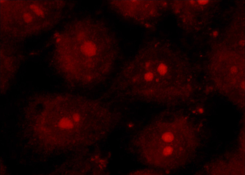 Immunofluorescent analysis of HepG2 cells, using TRPS1 antibody Catalog No:116414 at 1:50 dilution and Rhodamine-labeled goat anti-rabbit IgG (red).