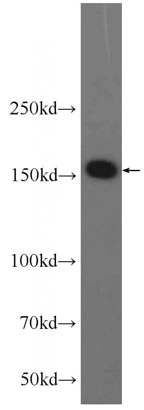 HEK-293 cells were subjected to SDS PAGE followed by western blot with Catalog No:108046(AQR Antibody) at dilution of 1:1500