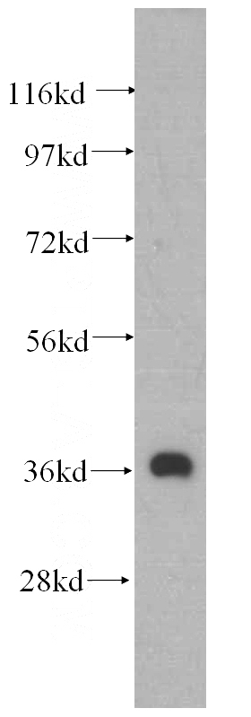 mouse heart tissue were subjected to SDS PAGE followed by western blot with Catalog No:112580(MECR antibody) at dilution of 1:500