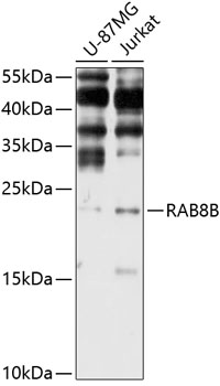 Western blot - RAB8B Polyclonal Antibody 