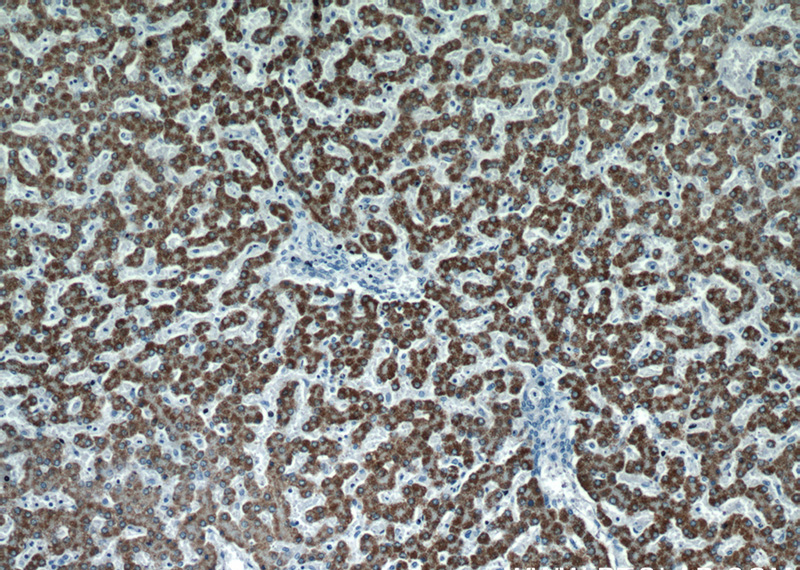 Immunohistochemical of paraffin-embedded human liver using Catalog No:114779(RocK2 antibody) at dilution of 1:100 (under 10x lens)