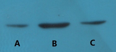 Western blot detection of Bcl-2 in human breast cancer cell line MCF-7(A), MDA-MB-231(B) and Cal51(C) using Bcl-2 mouse mAb (YM3041, 1:2000 diluted).Predicted band size: 26kDa.Observed band size:26kDa. Picture was kindly provided by our customer from Tianjin Medical University Cancer Institute and Hospital