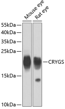 Western blot - CRYGS Polyclonal Antibody 