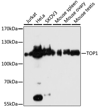 Western blot - TOP1 Polyclonal Antibody 