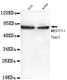 Western blot detection of MECT1 / Torc1 in Hela and Jurkat lysates using MECT1 / Torc1 mouse mAb (1:1000 diluted).Predicted band size: 78KDa.Observed band size: 78KDa.